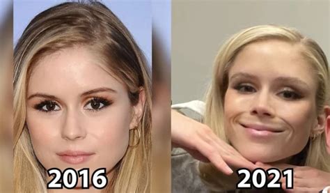 erin moriarty breast implants|Erin Moriarty Plastic Surgery: Analysis and Expert。